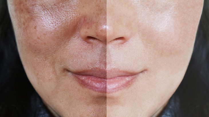 7 loại thực phẩm giúp chậm lão hóa da, ngừa cháy nắng  - Ảnh 2.