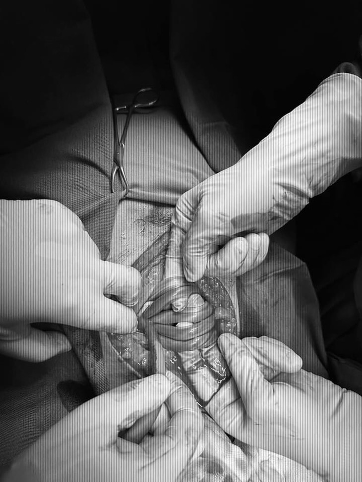 Bé gái với "vòng cổ đặc biệt" hiếm gặp đã chào đời an toàn - Ảnh 1.