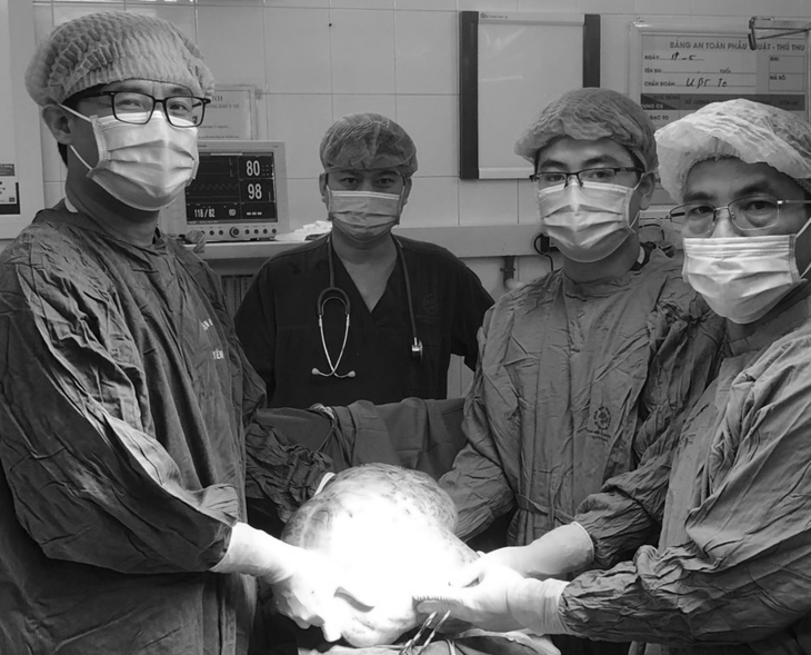 Nghĩ béo bụng người phụ nữ ở Tuyên Quang bất ngờ với khối u nặng gần 7kg - Ảnh 1.
