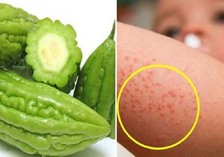 5 loại nước tắm trị rôm sảy cho trẻ trong mùa hè - Ảnh 3.
