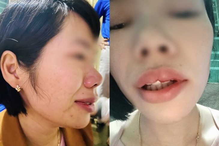 Thầy giáo hành hung đồng nghiệp vì con bị xếp hạnh kiểm trung bình - Ảnh 1. Thầy giáo hành hung đồng nghiệp vì con bị xếp hạnh kiểm trung bình - Ảnh 1.