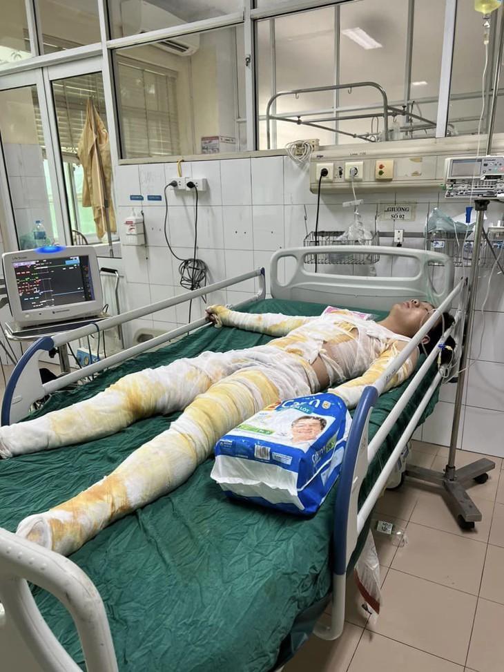 MS 843: Xót thương cậu bé mồ côi cha giờ có nguy cơ cưa bỏ chân vì tai nạn - Ảnh 2.