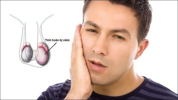 Đề phòng biến chứng nguy hiểm của quai bị - Ảnh 2.