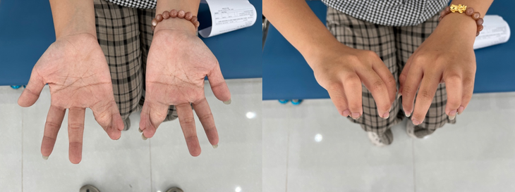 "Nâng bước tuổi thơ - Nâng bước thành công" mang phép màu đến 20 trẻ em dị tật bẩm sinh - Ảnh 2. "Nâng bước tuổi thơ - Nâng bước thành công" mang phép màu đến 20 trẻ em dị tật bẩm sinh - Ảnh 2.