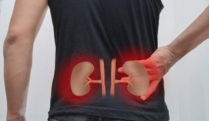 Dấu hiệu suy thận và phương pháp điều trị bệnh hiệu quả - Ảnh 1.
