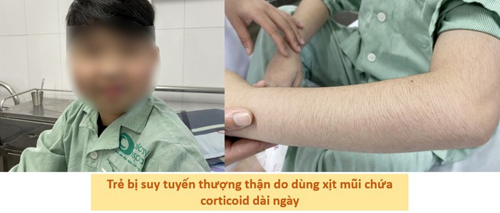 Giảm đau họng, ngừa cảm cúm - Ảnh 1.