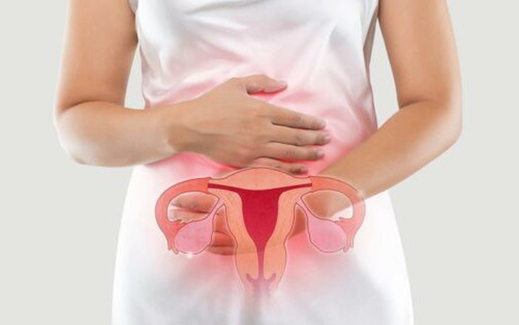 Các giai đoạn ung thư buồng trứng và khả năng đáp ứng điều trị