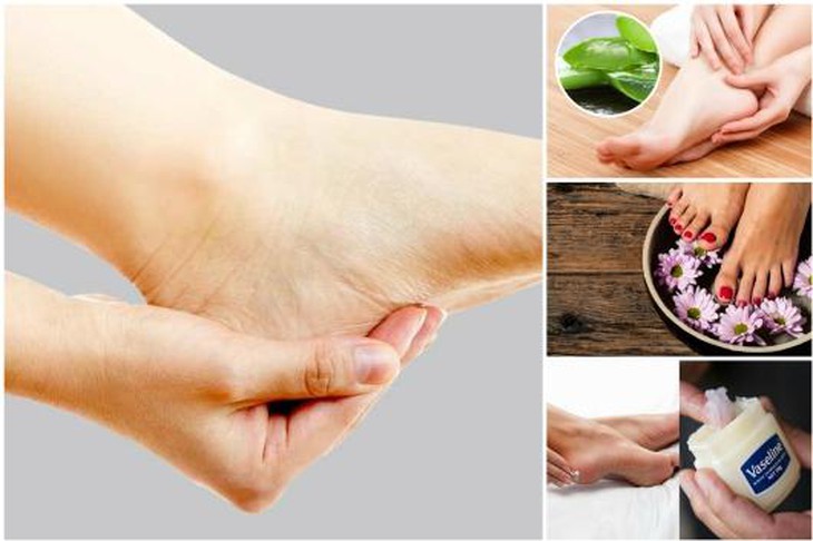 Nên ngâm chân với các nguyên liệu từ thiên nhiên có thể cải thiện tình trạng nứt gót chân. Ảnh minh họa
