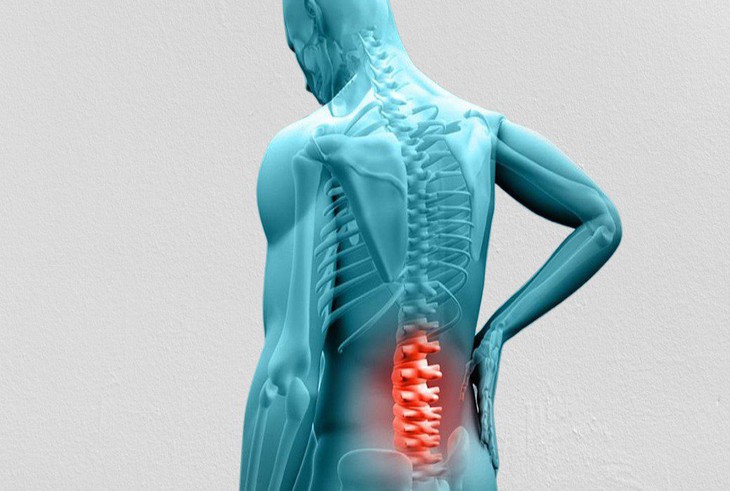 Thoát vị đĩa đệm có thể gây ra những biến chứng nguy hiểm nào? - Ảnh 2. Thoát vị đĩa đệm có thể gây ra những biến chứng nguy hiểm nào? - Ảnh 2.
