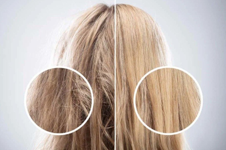 Tóc mỏng, tóc rụng và mẹo xử trí - Ảnh 1.