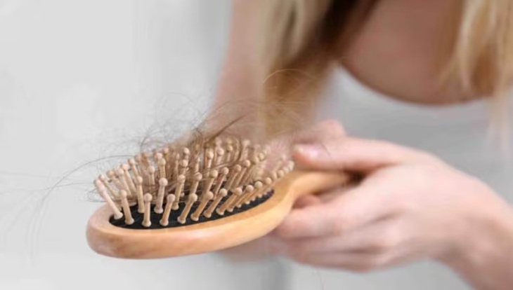 Mắc bệnh đái tháo đường có gây rụng tóc không? - Ảnh 2.