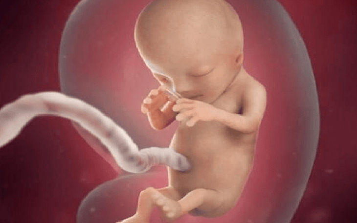 Mẹ bầu cần nhận biết dấu hiệu nghi ngờ nước ối ít