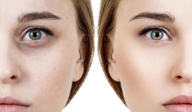 10 mẹo trang điểm che dấu nét mặt mệt mỏi - Ảnh 1.