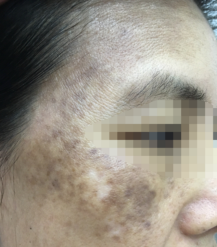 Uống 1 viên chống nắng phơi da cả ngày vẫn đẹp, có thực sự thần thánh như bạn nghĩ? - Ảnh 1.