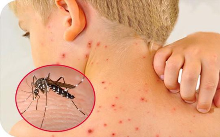 Bộ Y tế: Các tỉnh, thành tăng cường phòng chống sốt xuất huyết và dịch bệnh mùa hè