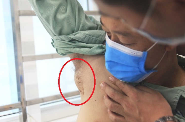 Hiếm gặp: Nam thanh niên 37 tuổi mắc bệnh mèo cào - Ảnh 1.