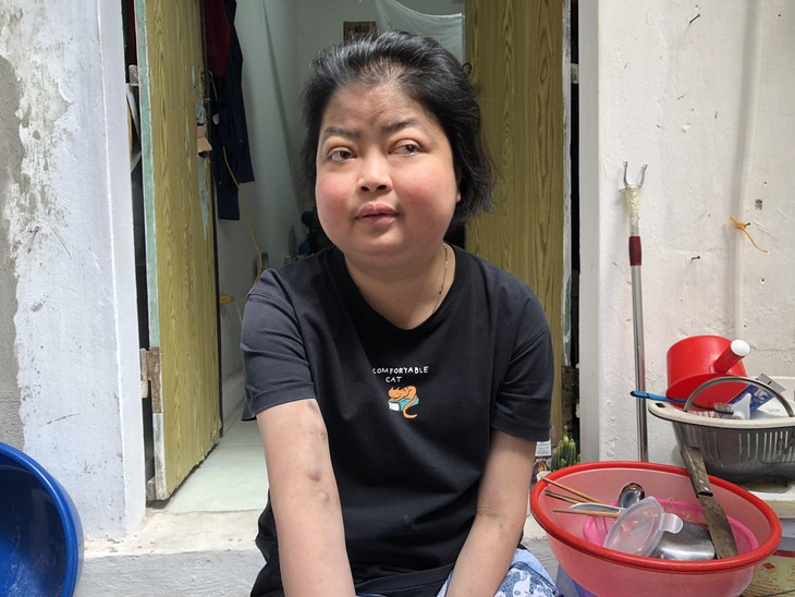 MS 854: Cuộc sống khốn cùng của cô gái mang đủ thứ bệnh trên người, nguy cơ hỏng hai mắt - Ảnh 3.