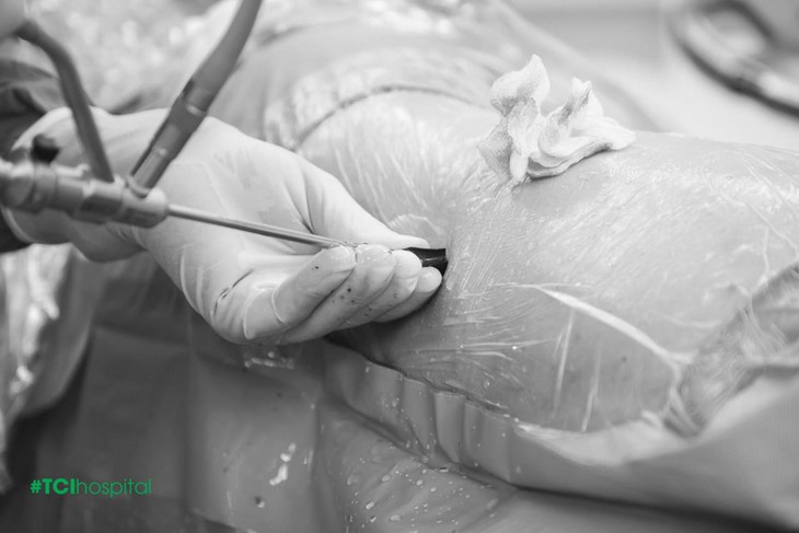 Cách lấy sạch 4 viên sỏi thận kích thước "khủng" trong 2 giờ - Ảnh 2.