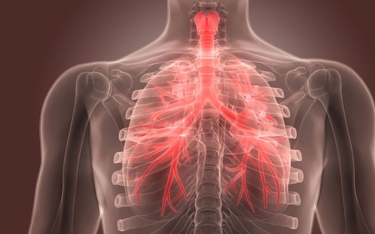 Viêm phế quản cấp ở người cao tuổi: Dấu hiệu cần lưu ý - Ảnh 1.