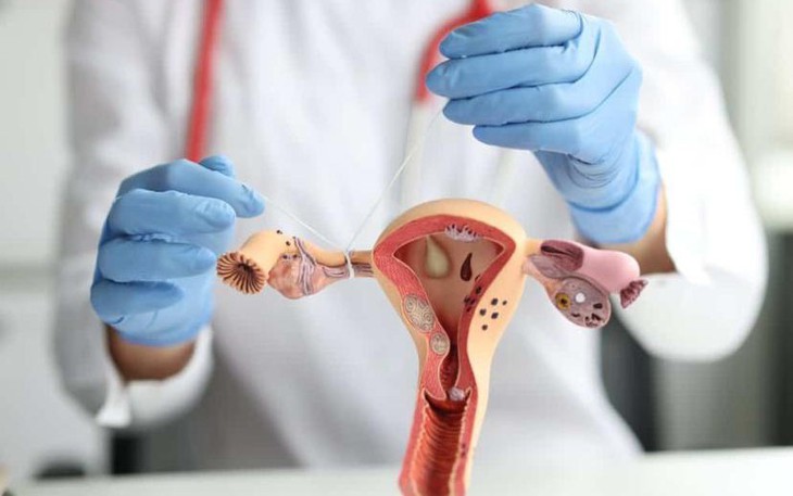 Cắt bỏ ống dẫn trứng có thể giảm nguy cơ ung thư buồng trứng?