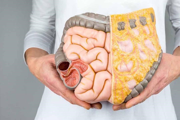 Sữa chua – trợ thủ đắc lực chống lại bệnh đường ruột trong mùa hè - Ảnh 1.