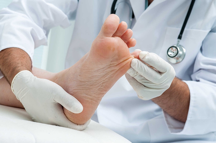 Triệu chứng bị tổ đỉa và những điều cần lưu ý - Ảnh 3.