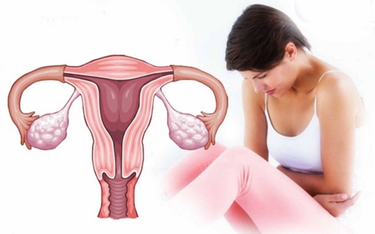 Bất thường ở tử cung ảnh hưởng đến khả năng sinh sản thế nào?