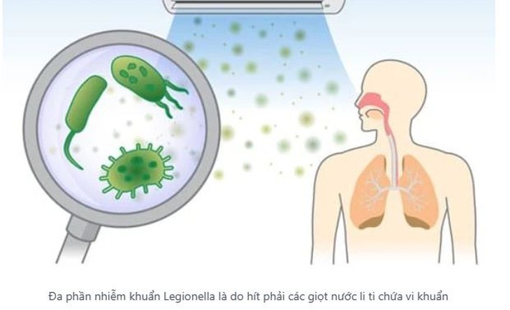 Viêm phổi không điển hình do vi khuẩn ở trẻ - Ảnh 1.