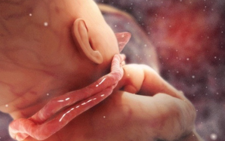 Điều mẹ bầu nên làm khi phát hiện "tràng hoa quấn cổ" em bé