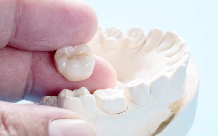 Những ai nên và không nên bọc răng sứ thẩm mỹ?