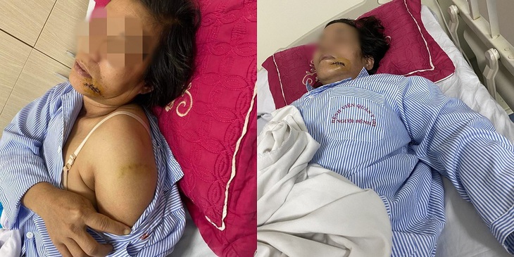 Bị đánh nhập viện vì nhắc hàng xóm nuôi chó làm 'mất vệ sinh' - Ảnh 1.