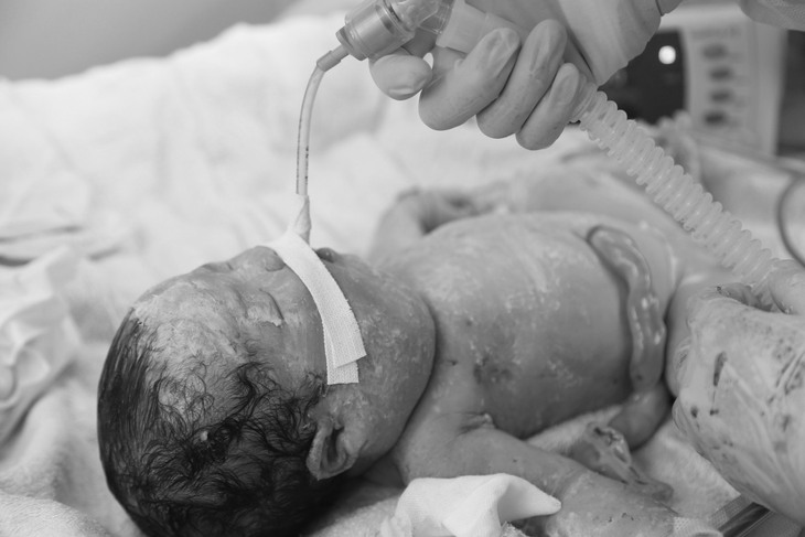 Cứu sống bé sơ sinh có khối u to vùng cổ ngay trước khi em bé chào đời - Ảnh 2. Cứu sống bé sơ sinh có khối u to vùng cổ ngay trước khi em bé chào đời - Ảnh 2.