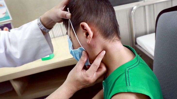 Điều nguy hiểm nữa là bệnh whitmore dễ tái phát, sức khỏe của bệnh nhân rất dễ suy kiệt do bệnh tái đi tái lại hoặc nếu điều trị không đúng phác đồ. Điều nguy hiểm nữa là bệnh whitmore dễ tái phát, sức khỏe của bệnh nhân rất dễ suy kiệt do bệnh tái đi tái lại hoặc nếu điều trị không đúng phác đồ.