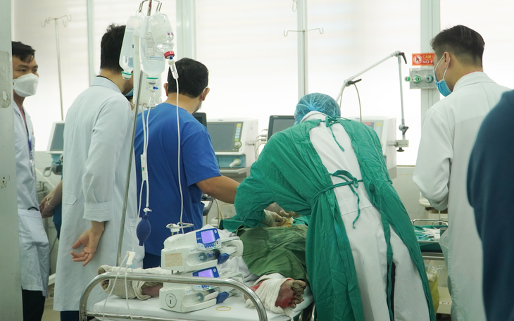 Vụ phóng hỏa ở Đồng Nai: 4 trẻ bỏng nặng phải thở máy, có trường hợp bỏng 90% cơ thể