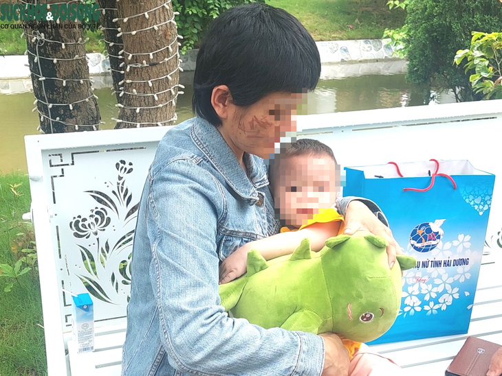 Nỗi ám ảnh của người phụ nữ mang bầu 7 tháng bị chồng ở Hải Dương bạo hành dã man - Ảnh 1.