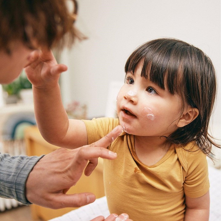 Những nguyên nhân chính gây ra mụn cho trẻ em - Ảnh 2. Những nguyên nhân chính gây ra mụn cho trẻ em - Ảnh 2.