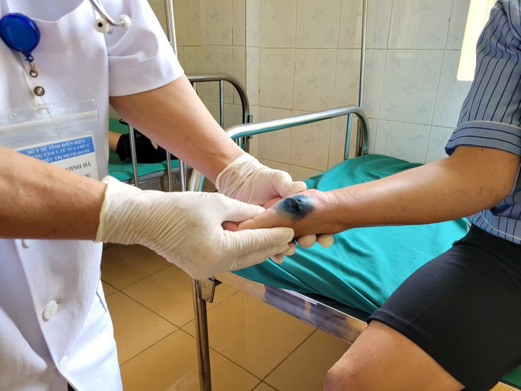 Điện Biên thông tin trường hợp trẻ nhỏ nghi mắc bệnh than - Ảnh 2.