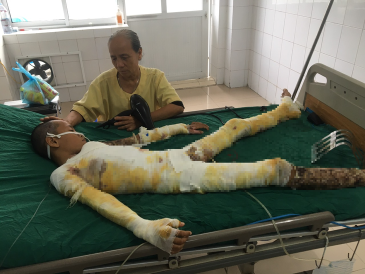 MS 851: Mẹ bầu 3 tháng khóc ngất cầu xin mọi người cứu con trai bỏng nặng vì điện giật - Ảnh 2. MS 851: Mẹ bầu 3 tháng khóc ngất cầu xin mọi người cứu con trai bỏng nặng vì điện giật - Ảnh 2.
