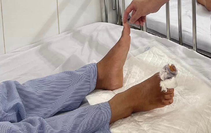 Nam thanh niên suýt mất 2 ngón chân khi vận hành máy nghiền mùn - Ảnh 2. Nam thanh niên suýt mất 2 ngón chân khi vận hành máy nghiền mùn - Ảnh 2.