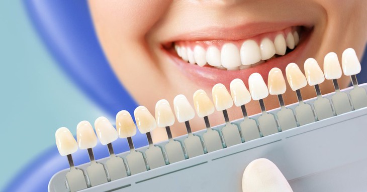 Răng ngả màu ố vàng và những lưu ý khi tẩy trắng răng - Ảnh 1. Răng ngả màu ố vàng và những lưu ý khi tẩy trắng răng - Ảnh 1.