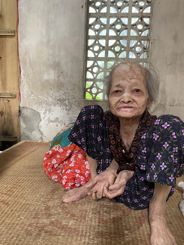 MS 860: Mong ước của người phụ nữ “đầu gối quá tai” trong căn nhà đổ nát vỏn vẹn 16m2 - Ảnh 2. MS 860: Mong ước của người phụ nữ “đầu gối quá tai” trong căn nhà đổ nát vỏn vẹn 16m2 - Ảnh 2.