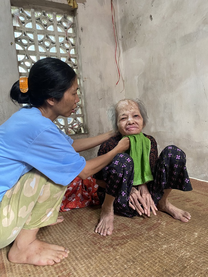 MS 860: Mong ước của người phụ nữ “đầu gối quá tai” trong căn nhà đổ nát vỏn vẹn 16m2 - Ảnh 6. MS 860: Mong ước của người phụ nữ “đầu gối quá tai” trong căn nhà đổ nát vỏn vẹn 16m2 - Ảnh 6.