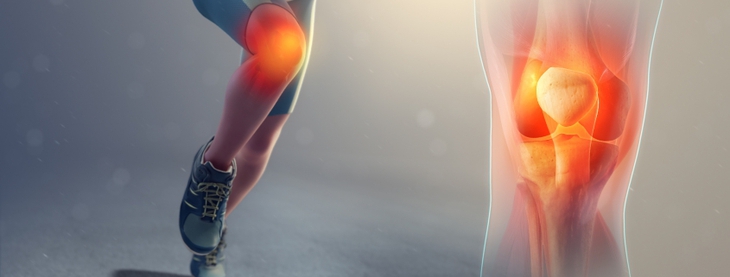 Bổ sung glucosamine, những ai nên thận trọng? - Ảnh 1.