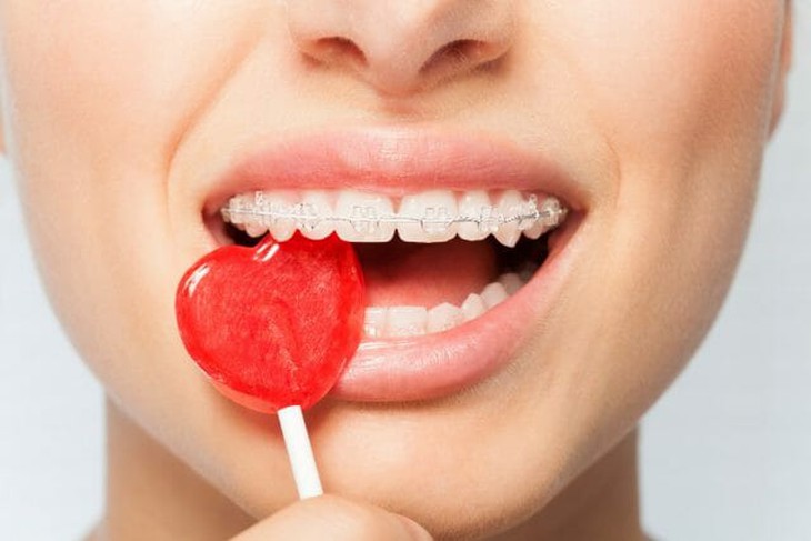 Mẹo nhỏ ăn ngon cho bạn đang niềng răng - Ảnh 5.