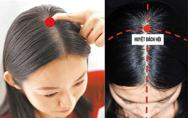 4 huyệt vị giúp làm giảm chứng chóng mặt