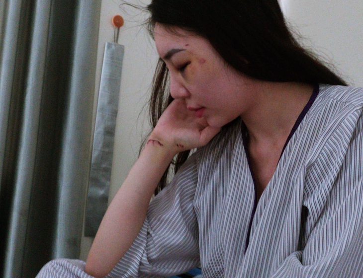 Thông tin mới vụ nhóm người hành hung cô gái vì nghi bị "nhìn đểu" - Ảnh 2. Thông tin mới vụ nhóm người hành hung cô gái vì nghi bị "nhìn đểu" - Ảnh 2.
