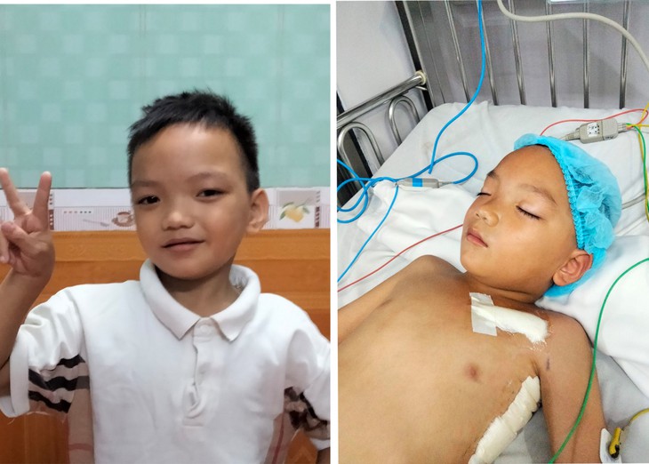 Thiếu tướng Đinh Văn Nơi trao 50 triệu đồng hỗ trợ bé trai 7 tuổi mổ tim - Ảnh 1. Thiếu tướng Đinh Văn Nơi trao 50 triệu đồng hỗ trợ bé trai 7 tuổi mổ tim - Ảnh 1.