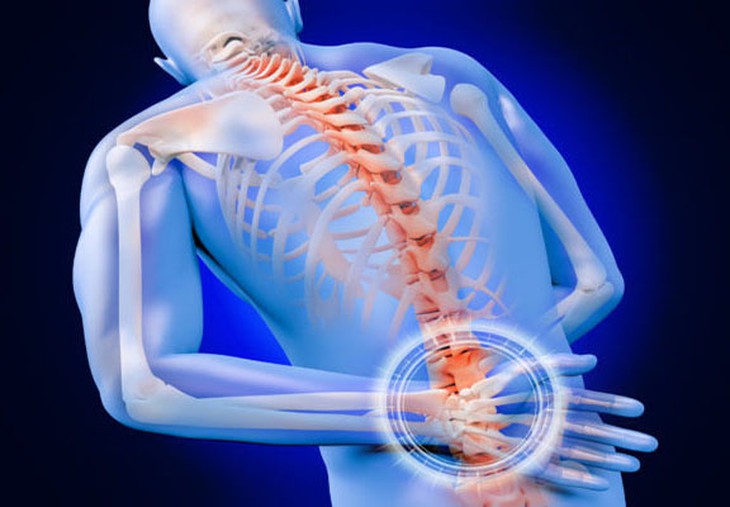 Thoái hóa cột sống thắt lưng gây những biến chứng khó lường - Ảnh 2.