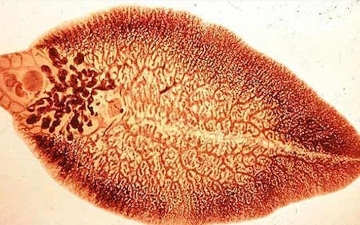 Nhiễm bệnh sán lá gan lớn do ăn rau sống
