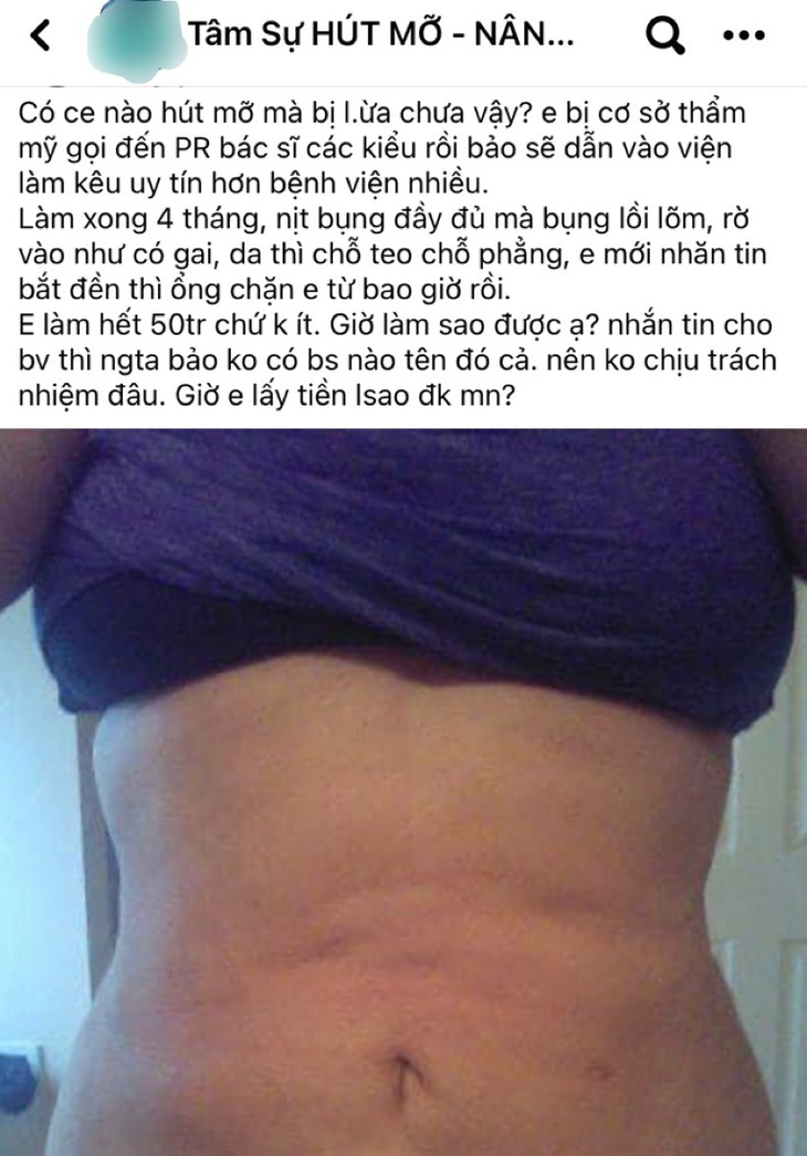 Cẩn trọng tránh "tiền mất tật mang" khi hút mỡ bụng tại các cơ sở không uy tín - Ảnh 1.